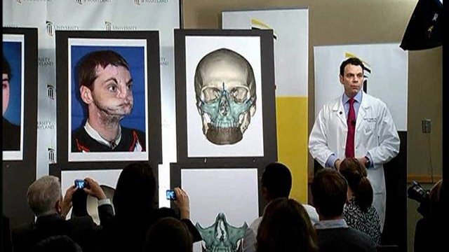 Cirujanos de EEUU realizan un revolucionario trasplante de cara 