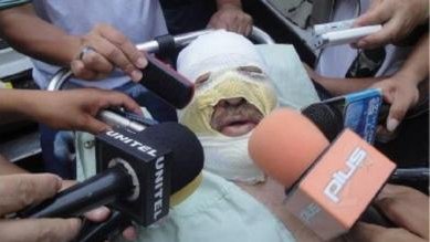 Encapuchados asaltan estación de radio en Bolivia y queman a periodista 