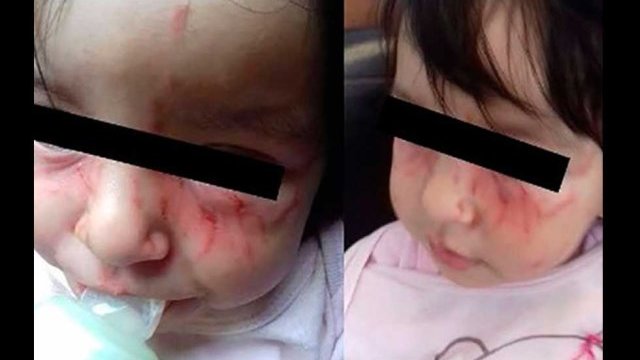 Por agresión entre bebés, clausuran guardería en Morelia