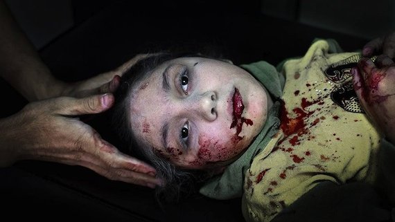 Foto de niña herida por bomba, foto del año para la UNICEF